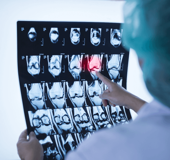 Personalized Solutions for Bone and Joint Care